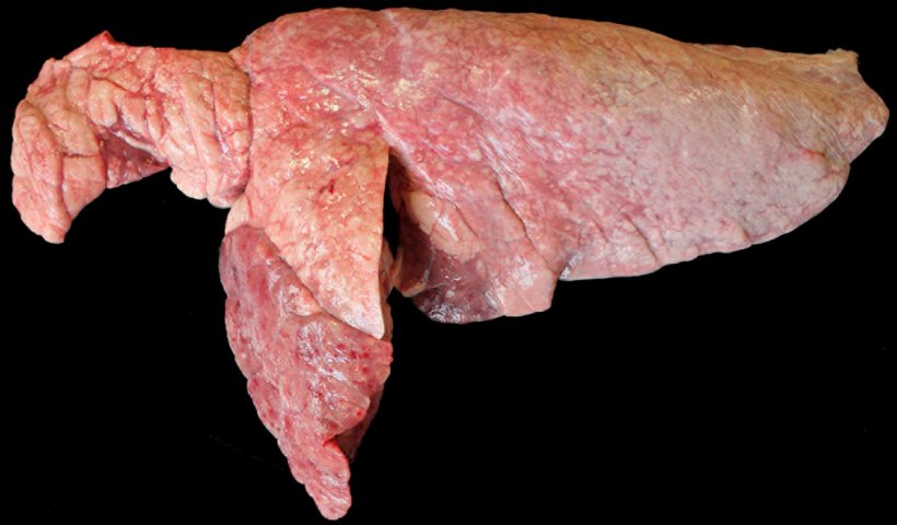 Фото 6. Коинфекция легких свиней&nbsp;M. hyopneumoniae&nbsp;и&nbsp;P. multocida. Красно-коричневые уплотнения в краниовентральной зоне, приподнятые по отношению к остальной части паренхимы легкого, что соответствует поражению, вызванному P. multocida. В краниальной доле и краниовентральном участке каудальной доли присутствуют красноватые уплотнения, которые соответствуют поражениям, вызванным&nbsp;M. hyopneumoniae.
